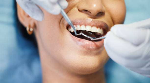 Best Emergency Cosmetic Dentistry (e.g., broken veneers) in Muscatine, IA