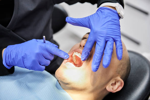 Best Dental Abscess Treatment in Muscatine, IA